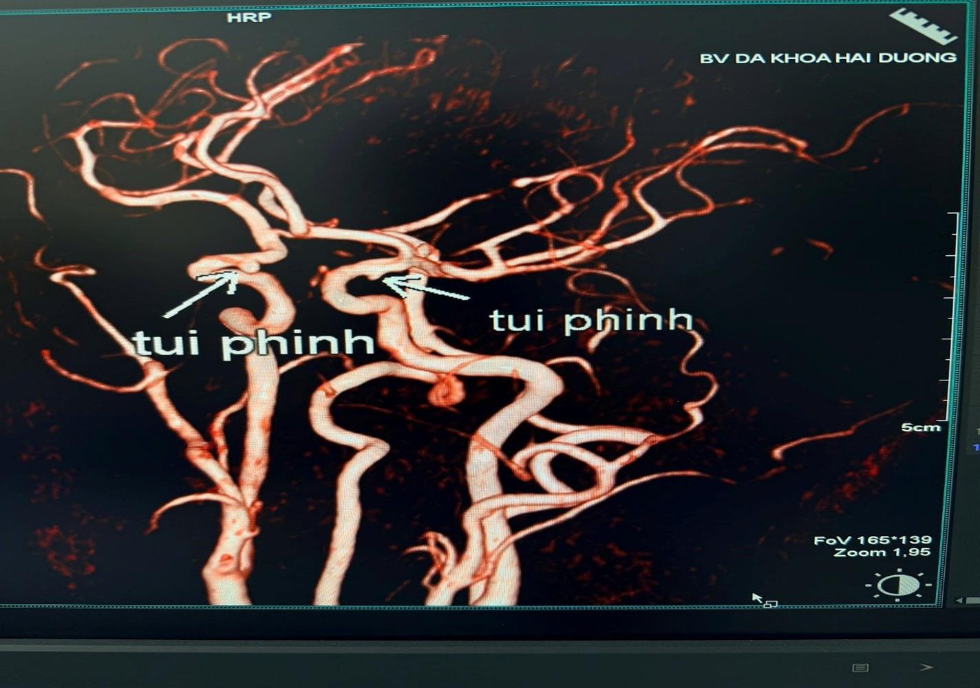 Kỷ Nguyên 3D MRI: 